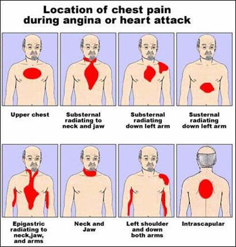 Chest Pain Australia First Aid Services